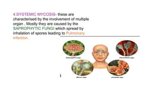 4.SYSTEMIC MYCOSIS- these are
characterised by the involvement of multiple
organ . Mostly they are caused by the
SAPROPHYTIC FUNGI which spread by
inhalation of spores leading to Pulmonary
infection.
 