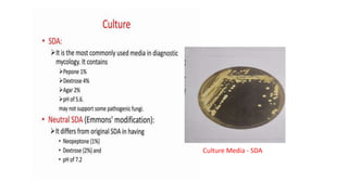 Culture Media - SDA
 