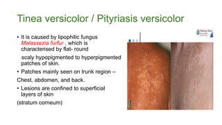 Tinea versicolor / Pityriasis versicolor
• It is caused by lipophilic fungus
Malassezia furfur , which is
characterised by flat- round
scaly hypopigmented to hyperpigmented
patches of skin.
• Patches mainly seen on trunk region –
Chest, abdomen, and back.
• Lesions are confined to superficial
layers of skin
(stratum corneum)
 
