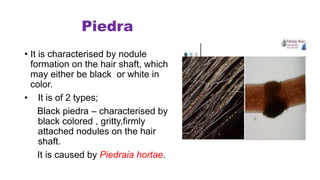 Piedra
• It is characterised by nodule
formation on the hair shaft, which
may either be black or white in
color.
• It is of 2 types;
Black piedra – characterised by
black colored , gritty,firmly
attached nodules on the hair
shaft.
It is caused by Piedraia hortae.
 