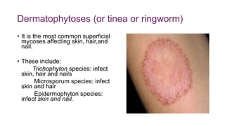 Dermatophytoses (or tinea or ringworm)
• It is the most common superficial
mycoses affecting skin, hair,and
nail.
• These include:
Trichophyton species: infect
skin, hair and nails
Microsporum species: infect
skin and hair
Epidermophyton species:
infect skin and nail.
 