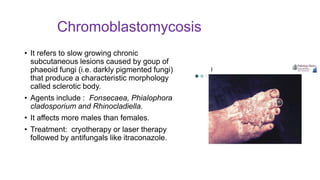 Chromoblastomycosis
• It refers to slow growing chronic
subcutaneous lesions caused by goup of
phaeoid fungi (i.e. darkly pigmented fungi)
that produce a characteristic morphology
called sclerotic body.
• Agents include : Fonsecaea, Phialophora
cladosporium and Rhinocladiella.
• It affects more males than females.
• Treatment: cryotherapy or laser therapy
followed by antifungals like itraconazole.
 