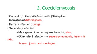 2. Coccidiomycosis
• Caused by : Cocxidiodes immitis (Dimorphic)
• Inhalation of Arthrospores.
• Primary infection : Lungs.
• Secondary infection :
- May spread to other organs including skin.
- Other silent infections – severe pneumonia, lesions in
skin,
bones , joints, and meninges.
 