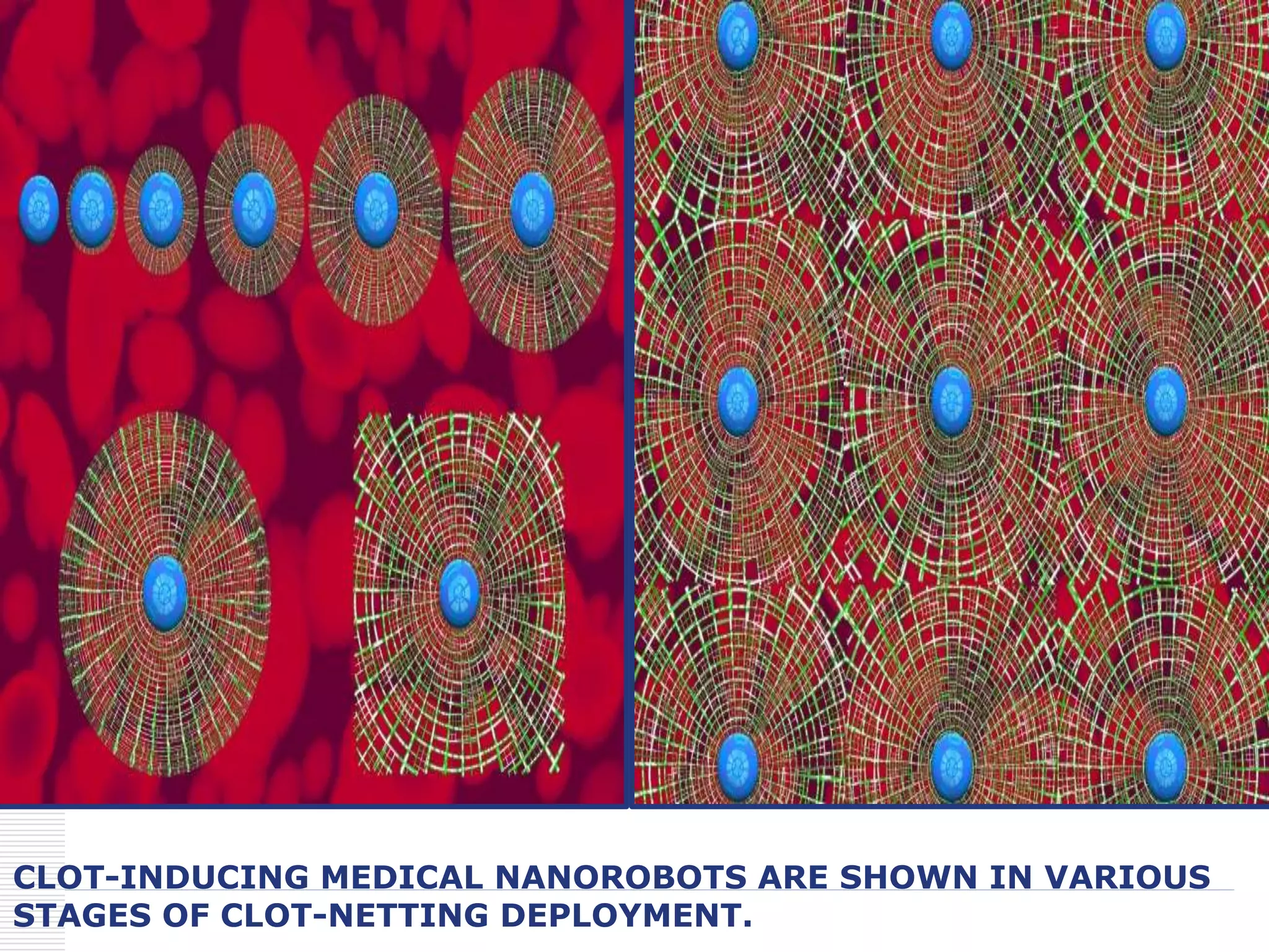 CLOT-INDUCING MEDICAL NANOROBOTS ARE SHOWN IN VARIOUS
STAGES OF CLOT-NETTING DEPLOYMENT.
 