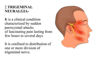 2.TRIGEMINAL
NEURALGIA-
It is a clinical condition
characterized by sudden
paroxysmal attacks
of lancinating pain lasting from
few hours to several days
It is confined to distribution of
one or more division of
trigeminal nerve.
 