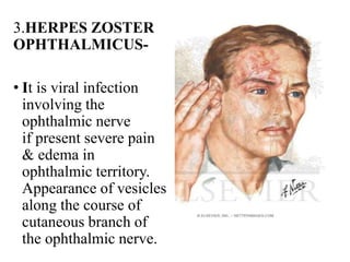 Nerve supply of face & applied