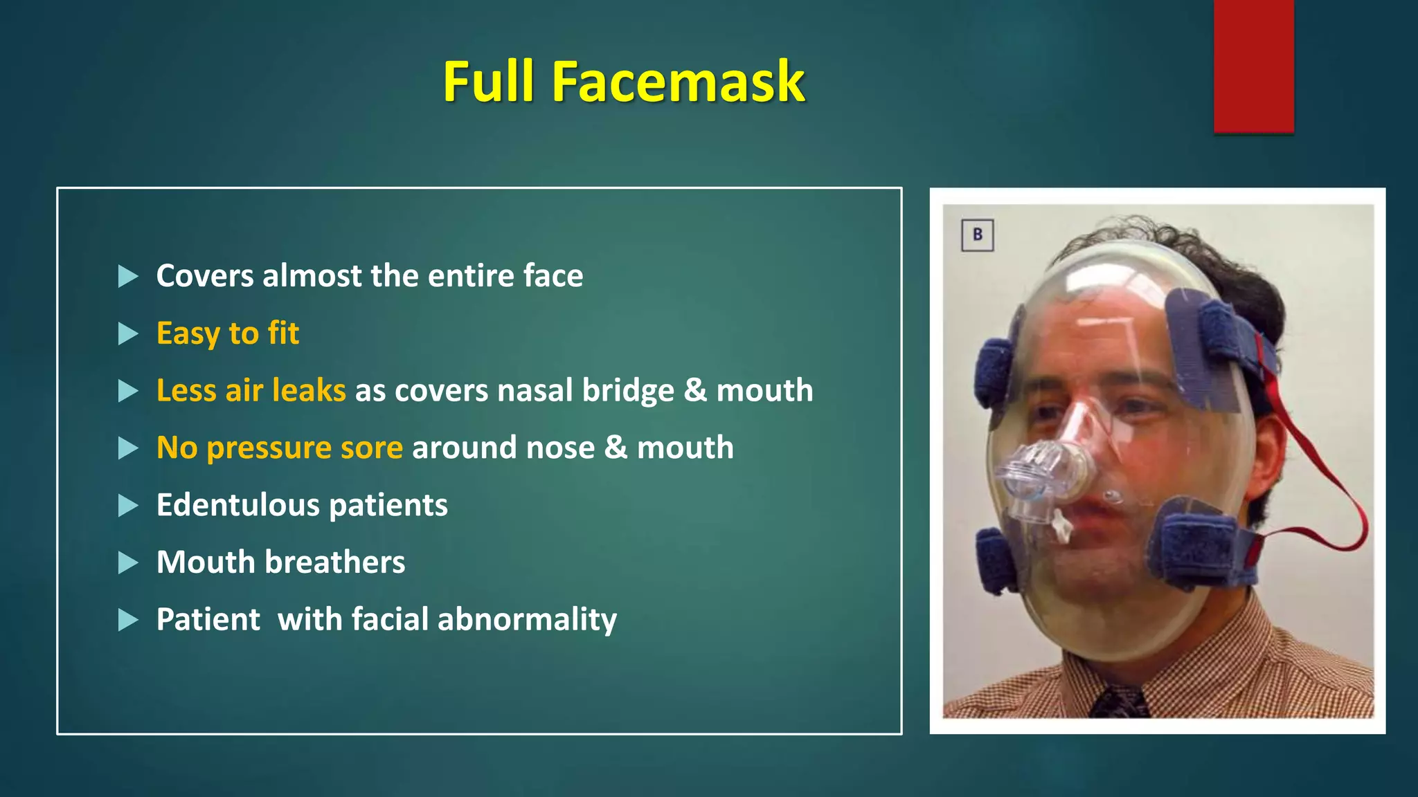 Full Facemask
 Covers almost the entire face
 Easy to fit
 Less air leaks as covers nasal bridge & mouth
 No pressure sore around nose & mouth
 Edentulous patients
 Mouth breathers
 Patient with facial abnormality
 