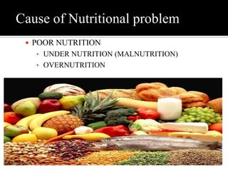 Cause of Nutritional problem
 POOR NUTRITION
• UNDER NUTRITION (MALNUTRITION)
• OVERNUTRITION
 