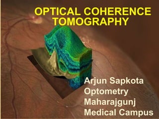 OPTICAL COHERENCE
TOMOGRAPHY
Arjun Sapkota
Optometry
Maharajgunj
Medical Campus
 