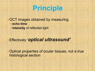 OCT images obtained by measuring
 echo time
 intensity of reflected light
Effectively ‘optical ultrasound’
Optical properties of ocular tissues, not a true
histological section
Principle
 