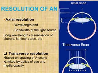 RESOLUTION OF AN OCT
Axial resolution
-Wavelength and
-Bandwidth of the light source
Long wavelength - visualisation of
choroid, laminar pores, etc
 Transverse resolution
•Based on spacing of A-scans
•Limited by optics of eye and
media opacity
 