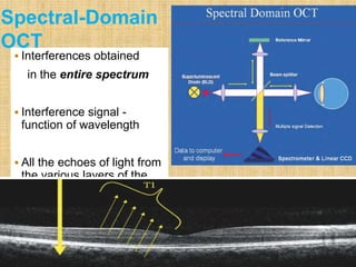  Interferences obtained
in the entire spectrum
 Interference signal -
function of wavelength
 All the echoes of light from
the various layers of the
retina measured
simultaneously
Spectral-Domain
OCT
 