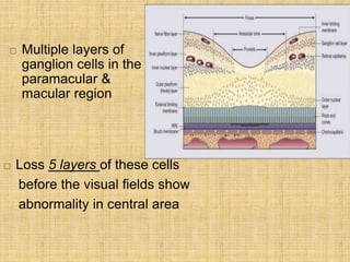 Multiple layers of
ganglion cells in the
paramacular &
macular region
 Loss 5 layers of these cells
before the visual fields show
abnormality in central area
 