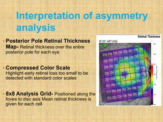  Posterior Pole Retinal Thickness
Map- Retinal thickness over the entire
posterior pole for each eye
 Compressed Color Scale
Highlight early retinal loss too small to be
detected with standard color scales
 8x8 Analysis Grid- Positioned along the
fovea to disc axis Mean retinal thickness is
given for each cell
Interpretation of asymmetry
analysis
 