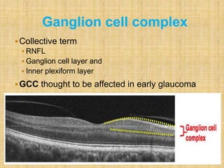 Collective term
 RNFL
 Ganglion cell layer and
 Inner plexiform layer
GCC thought to be affected in early glaucoma
Ganglion cell complex
 