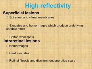 Epiretinal and vitreal membranes
Exudates and hemorrhages which produce underlying
shadow effect
Cotton wool spots
High reflectivity
Superficial lesions
Intraretinal lesions
Hemorrhages
Hard exudates
Retinal fibrosis and disciform degenerative scars
 