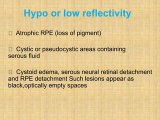Atrophic RPE (loss of pigment)
Cystic or pseudocystic areas containing
serous fluid
Cystoid edema, serous neural retinal detachment
and RPE detachment Such lesions appear as
black,optically empty spaces
Hypo or low reflectivity
 