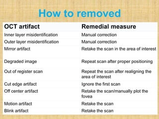OCT artifact Remedial measure
Inner layer misidentification Manual correction
Outer layer misidentification Manual correction
Mirror artifact Retake the scan in the area of interest
Degraded image Repeat scan after proper positioning
Out of register scan Repeat the scan after realigning the
area of interest
Cut edge artifact Ignore the first scan
Off center artifact Retake the scan/manually plot the
fovea
Motion artifact Retake the scan
Blink artifact Retake the scan
How to removed
 