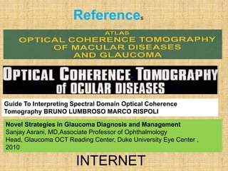 References
Guide To Interpreting Spectral Domain Optical Coherence
Tomography BRUNO LUMBROSO MARCO RISPOLI
INTERNET
Novel Strategies in Glaucoma Diagnosis and Management
Sanjay Asrani, MD,Associate Professor of Ophthalmology
Head, Glaucoma OCT Reading Center, Duke University Eye Center ,
2010
 