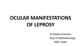 OCULAR MANIFESTATIONS
OF LEPROSY
Dr Kalpita Gumaste
Dept of Ophthalmology
KIMS ,Hubli
 