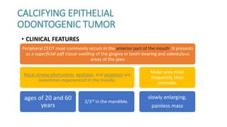 Odontogenic Tumors Oral Pathology | PPTX
