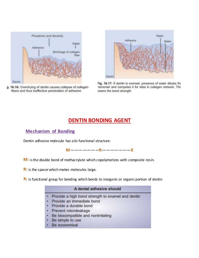 Bonding to Enamel and Dentin Bonding to Enamel and Dentin