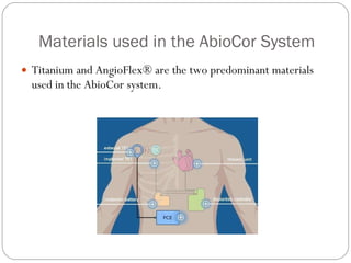 The AbioCor System: Overview | PPT