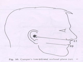 Orientation Relation 109
 