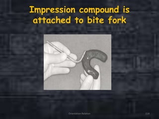 Impression compound is
attached to bite fork
Orientation Relation 114
 
