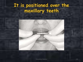 It is positioned over the
maxillary teeth
Orientation Relation 115
 