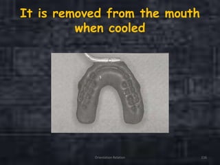 It is removed from the mouth
when cooled
Orientation Relation 116
 