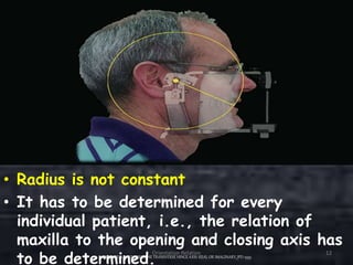 • Radius is not constant
• It has to be determined for every
individual patient, i.e., the relation of
maxilla to the opening and closing axis has
to be determined.LAWRENCEA. WEINBERG, THE TRANSVERSE HINGEAXIS: REAL OR IMAGINARY,JPD 1959
Orientation Relation 12
 