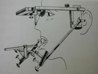 Orientation Relation 126
 