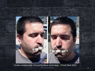 Orientation Relation 130
Eneko solaberrieta .Virtual facebow technique J Prost Dent 2015
 