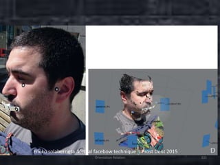 Orientation Relation 131
Eneko solaberrieta .Virtual facebow technique J Prost Dent 2015
 