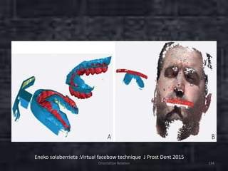 Orientation Relation 134
Eneko solaberrieta .Virtual facebow technique J Prost Dent 2015
 