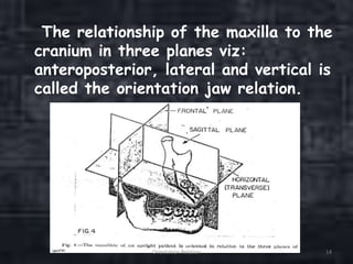 The relationship of the maxilla to the
cranium in three planes viz:
anteroposterior, lateral and vertical is
called the orientation jaw relation.
Orientation Relation 14
 
