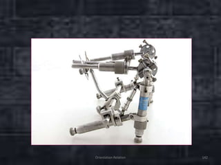 Orientation Relation 142
 