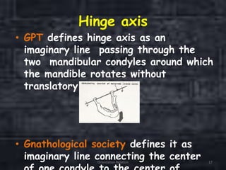 Hinge axis
• GPT defines hinge axis as an
imaginary line passing through the
two mandibular condyles around which
the mandible rotates without
translatory movement.
• Gnathological society defines it as
imaginary line connecting the centerOrientation Relation 17
 