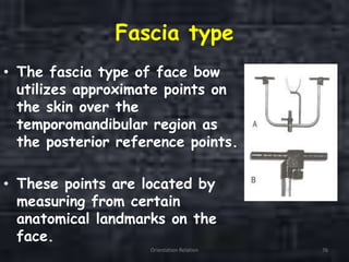 Fascia type
• The fascia type of face bow
utilizes approximate points on
the skin over the
temporomandibular region as
the posterior reference points.
• These points are located by
measuring from certain
anatomical landmarks on the
face.
Orientation Relation 76
 