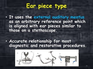 Ear piece type
• It uses the external auditory meatus
as an arbitrary reference point which
is aligned with ear pieces similar to
those on a stethoscope.
• Accurate relationship for most
diagnostic and restorative procedures.
Orientation Relation 78
 