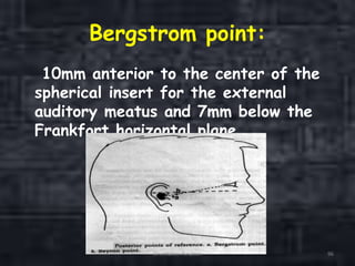 Bergstrom point:
10mm anterior to the center of the
spherical insert for the external
auditory meatus and 7mm below the
Frankfort horizontal plane.
Orientation Relation 96
 