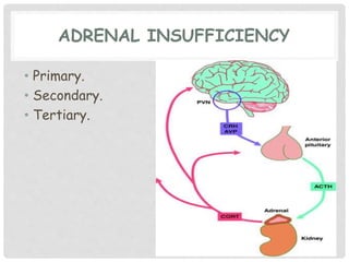 Primary Adrenal Insufficiency | PPTX