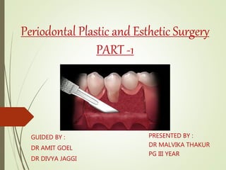 Periodontal Plastic and Esthetic Surgery
PART -1
GUIDED BY :
DR AMIT GOEL
DR DIVYA JAGGI
PRESENTED BY :
DR MALVIKA THAKUR
PG III YEAR
 