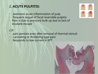 2. ACUTE PULPITIS:
• extensive acute inflammation of pulp
• frequent sequel of focal reversible pulpitis
• Pain is due to pressure built up due to lack of
exudate escape
C/F:
• pain persists even after removal of thermal stimuli
• Lacinating or throbbing type pain
• Responds to low current in EPT
 