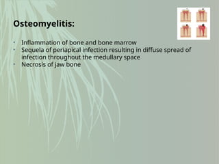 Osteomyelitis:
• Inflammation of bone and bone marrow
• Sequela of periapical infection resulting in diffuse spread of
infection throughout the medullary space
• Necrosis of jaw bone
 