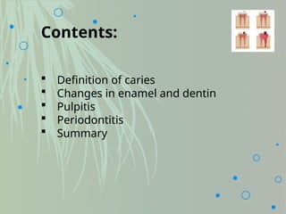 Contents:
 Definition of caries
 Changes in enamel and dentin
 Pulpitis
 Periodontitis
 Summary
 
