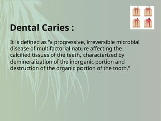 It is defined as “a progressive, irreversible microbial
disease of multifactorial nature affecting the
calcified tissues of the teeth, characterized by
demineralization of the inorganic portion and
destruction of the organic portion of the tooth.”
Dental Caries :
 