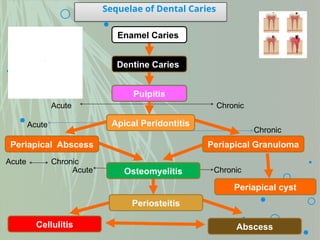 Sequelae of Dental Caries
Enamel Caries
Dentine Caries
Pulpitis
Apical Peridontitis
Periapical Abscess Periapical Granuloma
Osteomyelitis
Periosteitis
Abscess
Cellulitis
Acute Chronic
Acute
Chronic
Acute Chronic
Acute Chronic
Periapical cyst
 