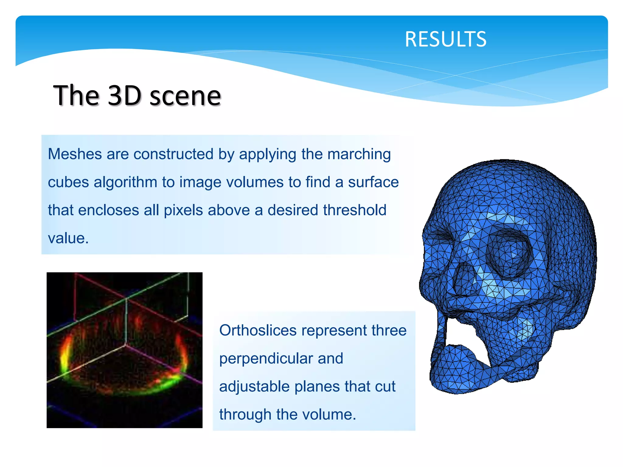 RESULTS

The 3D scene
Meshes are constructed by applying the marching
cubes algorithm to image volumes to find a surface
that encloses all pixels above a desired threshold
value.




                         Orthoslices represent three
                         perpendicular and
                         adjustable planes that cut
                         through the volume.
 